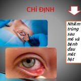 Dropstar-vs-Qnovid-mo---tinefin-17