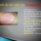 Dropstar-vs-Qnovid-mo---tinefin-26